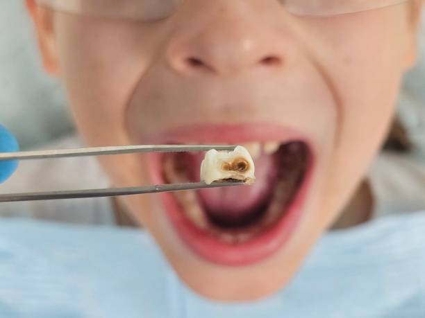 Best Emergency Gum Pain Relief  in Ddleville, MI