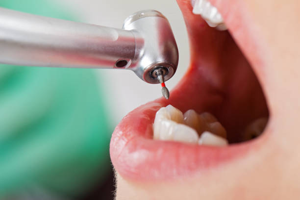 Best Broken Tooth Emergency  in Ddleville, MI